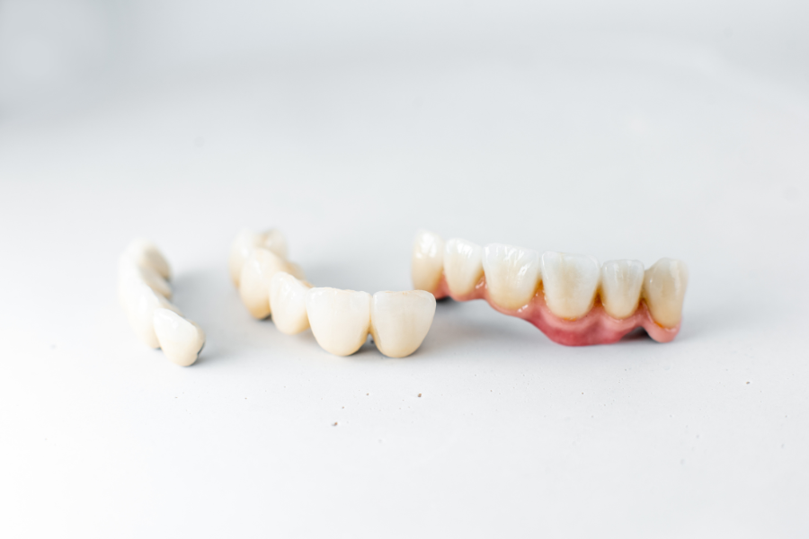 What to Do If Your Dental Crown Falls Off